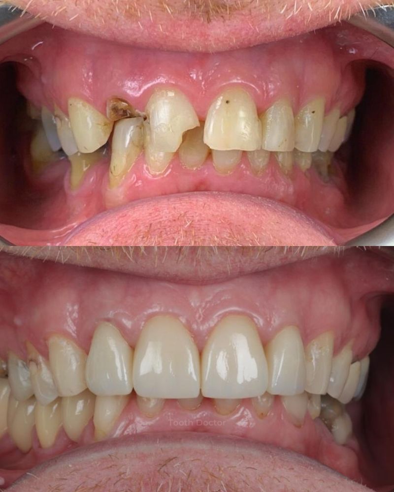 Tooth Doctor | Gerard Skeffington Tooth Doctor | Gerard Skeffington