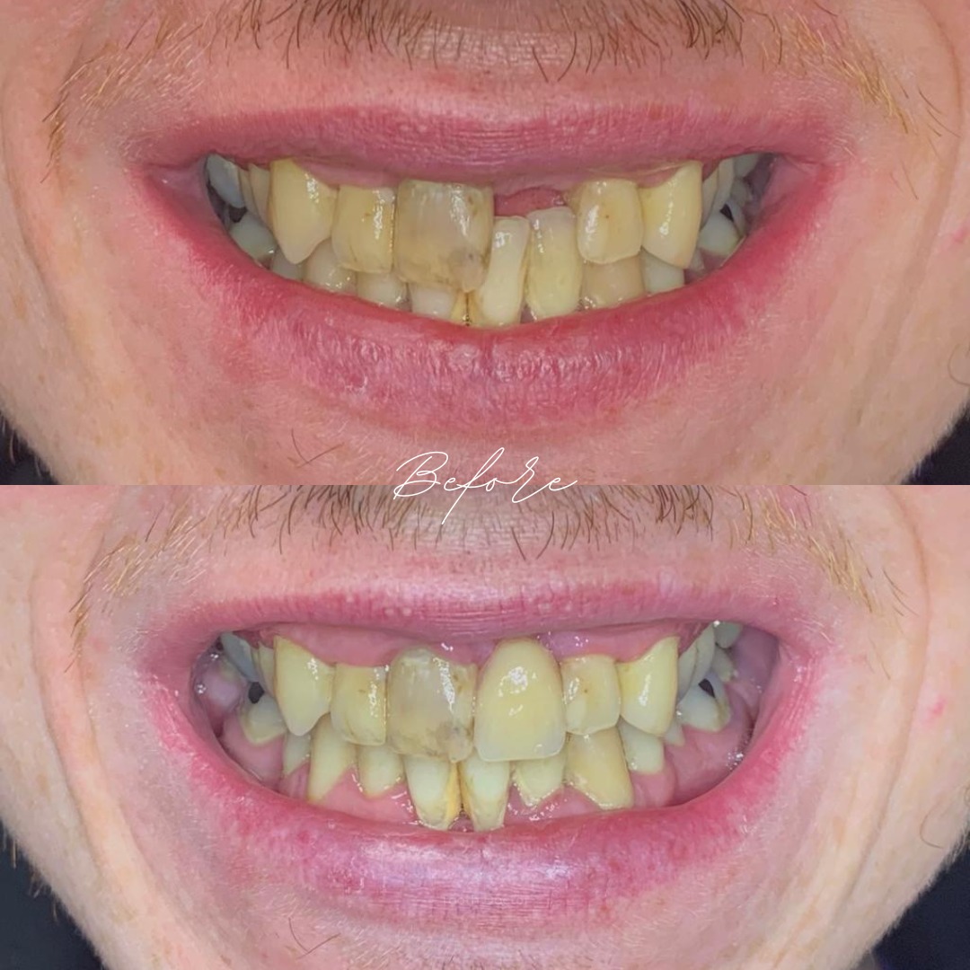 Tooth Doctor | Dental Implants Carluke Replace Missing Teeth Tooth Doctor | Dental Implants Carluke Replace Missing Teeth