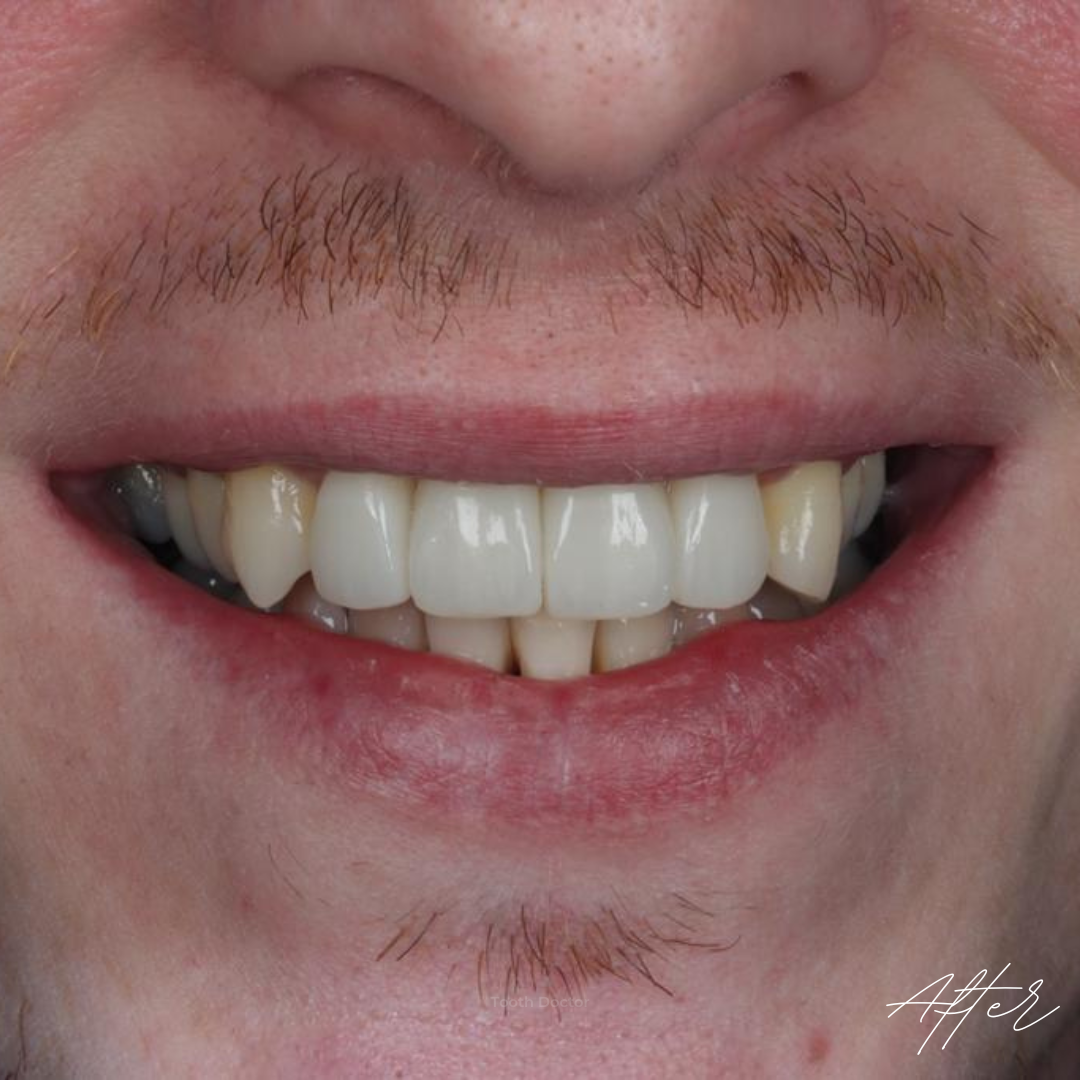Tooth Doctor | Dental Implants Carluke Replace Missing Teeth Tooth Doctor | Dental Implants Carluke Replace Missing Teeth