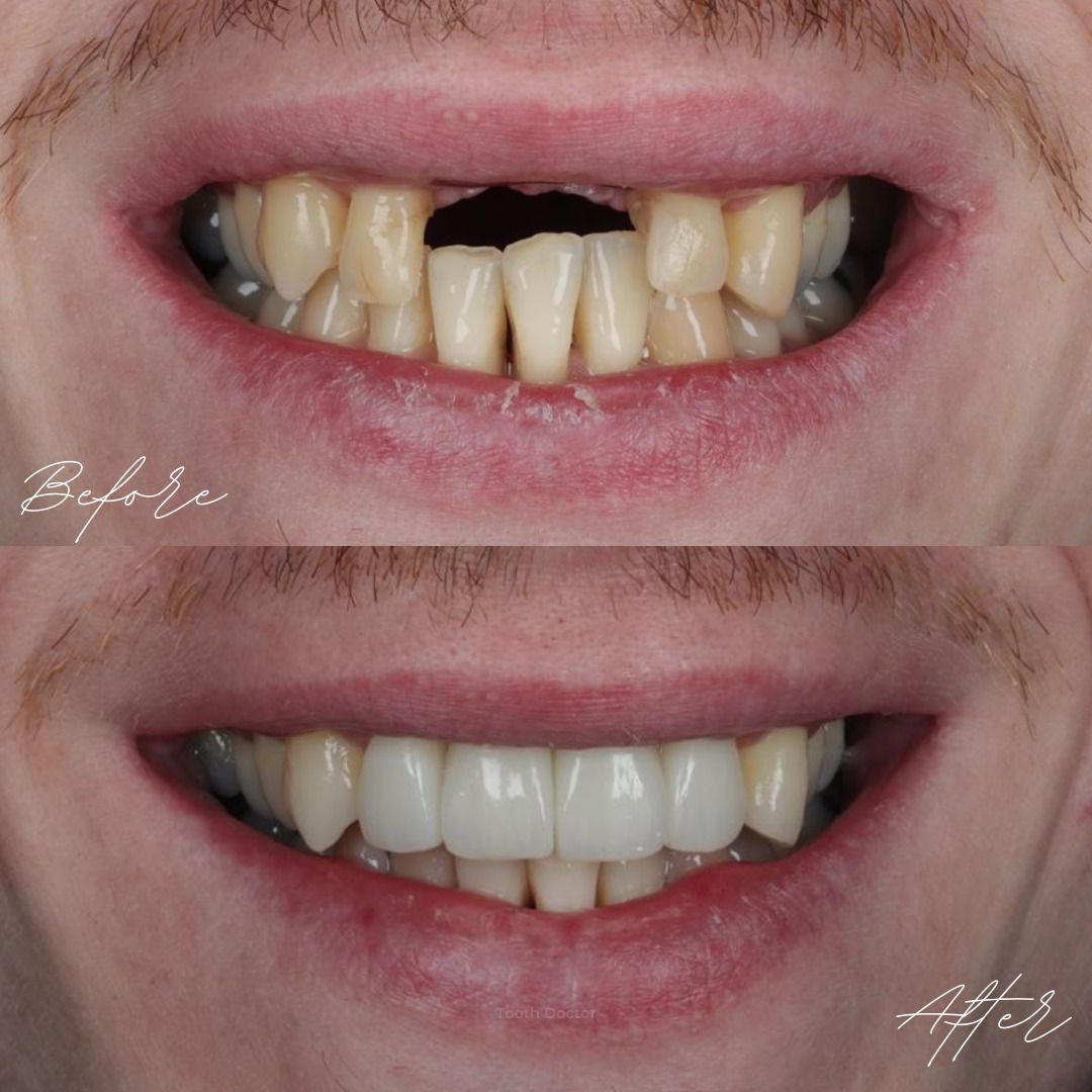Tooth Doctor | Dental Implants Carluke Replace Missing Teeth Tooth Doctor | Dental Implants Carluke Replace Missing Teeth