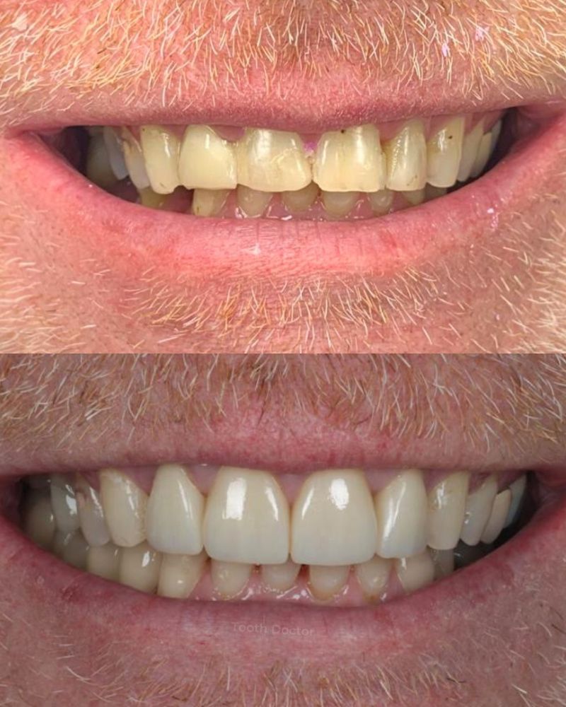 Tooth Doctor | Gerard Skeffington Tooth Doctor | Gerard Skeffington