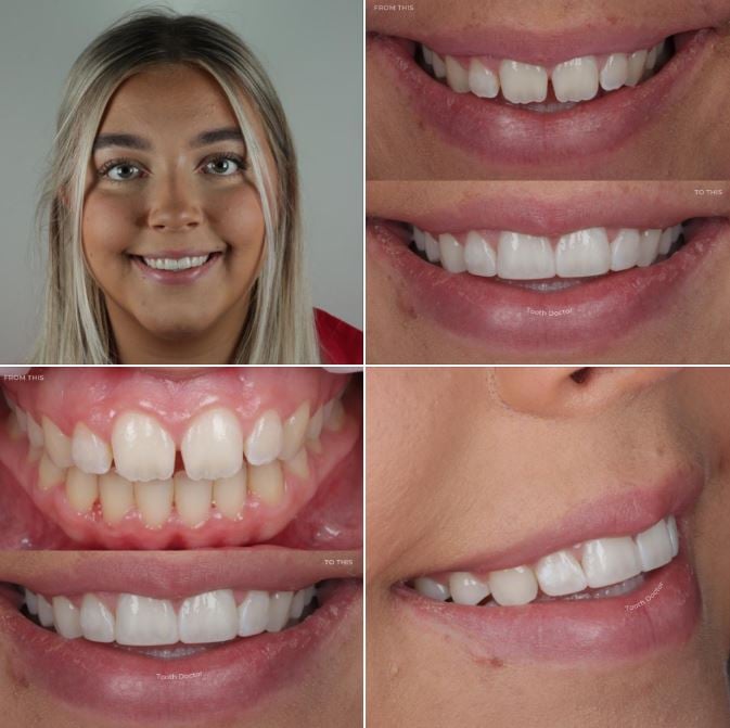 Complimentary Consultation With A Smile Advisor