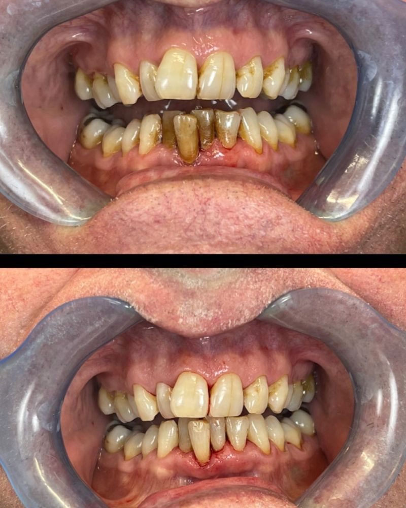 Before & after treatment with Kelly