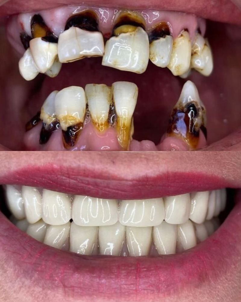 Before & after treatment with Sofia
