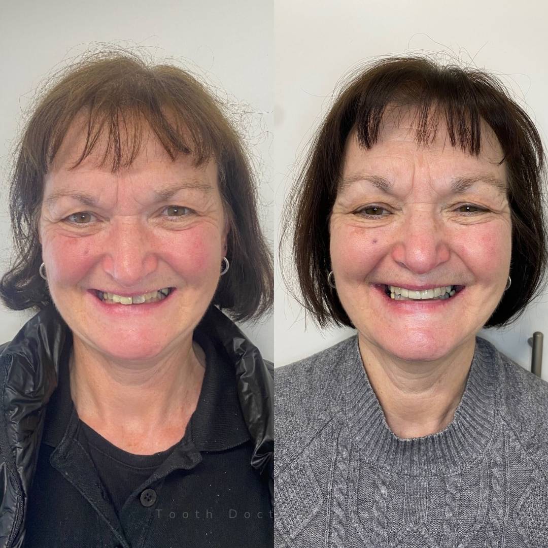 Before and after treatment