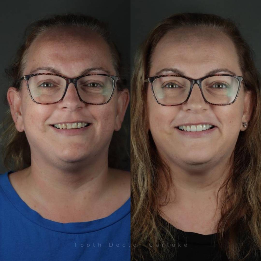 Before and after treatment