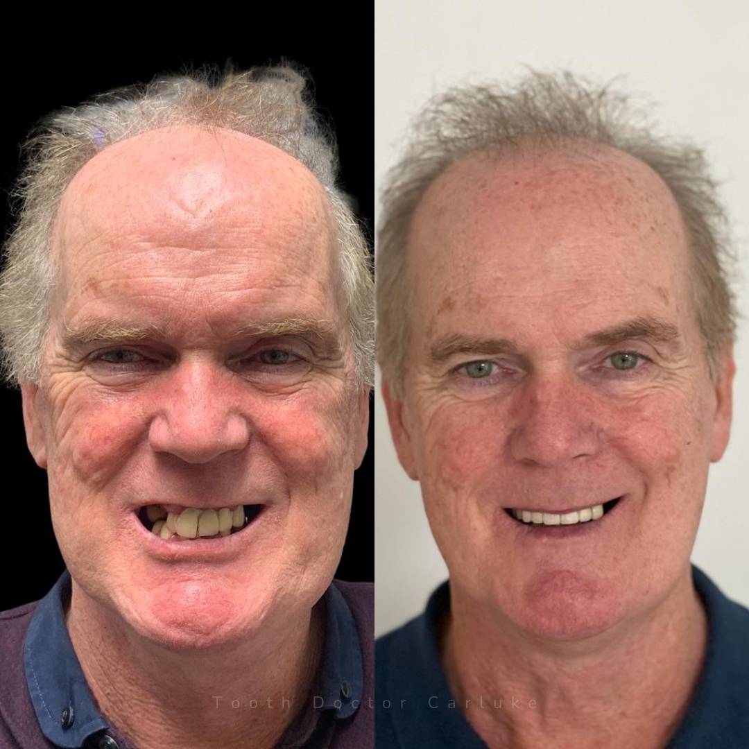 Before and after treatment