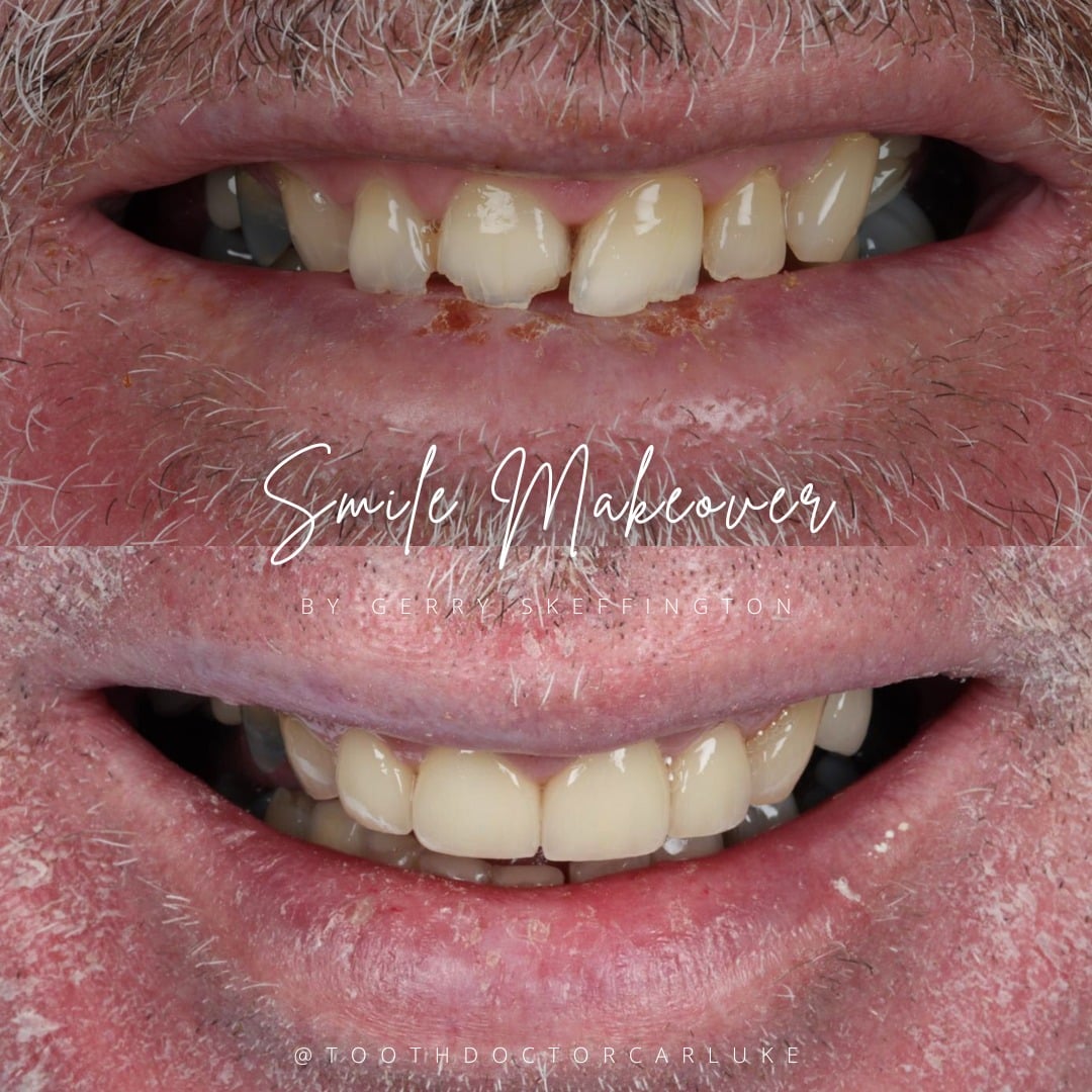 Before and after treatment at Tooth Doctor