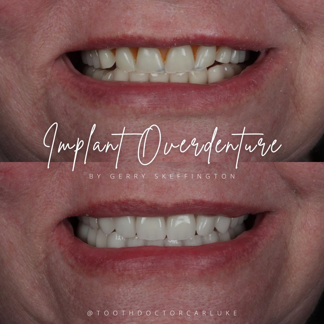 Tooth Doctor | Dental Implants Carluke Replace Missing Teeth Tooth Doctor | Dental Implants Carluke Replace Missing Teeth