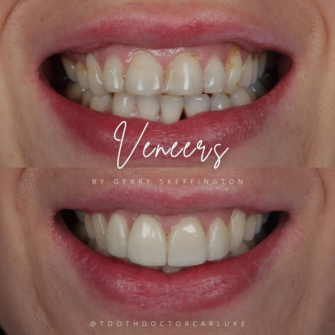 Before and after treatment at Tooth Doctor