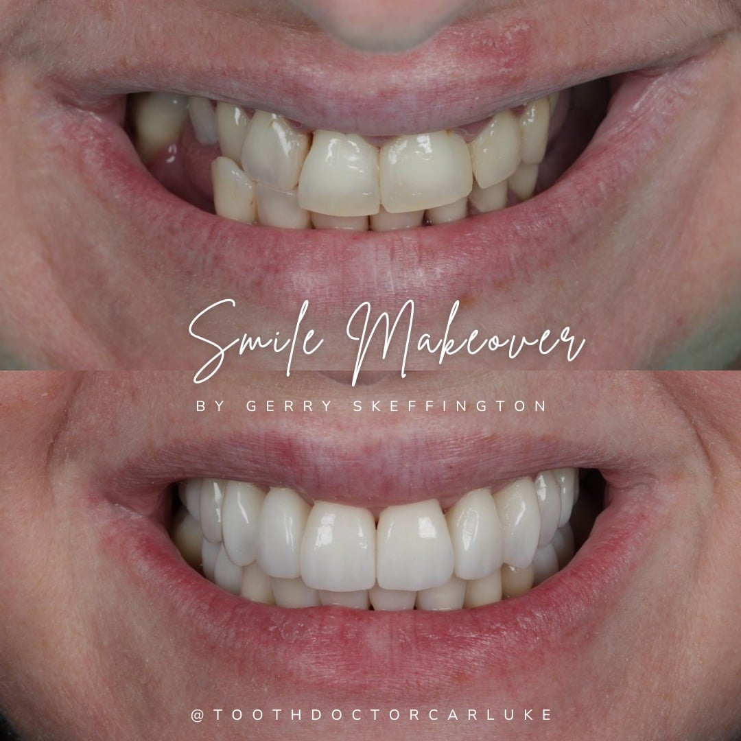 Before and after treatment at Tooth Doctor