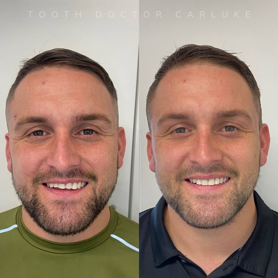 Before and after treatment