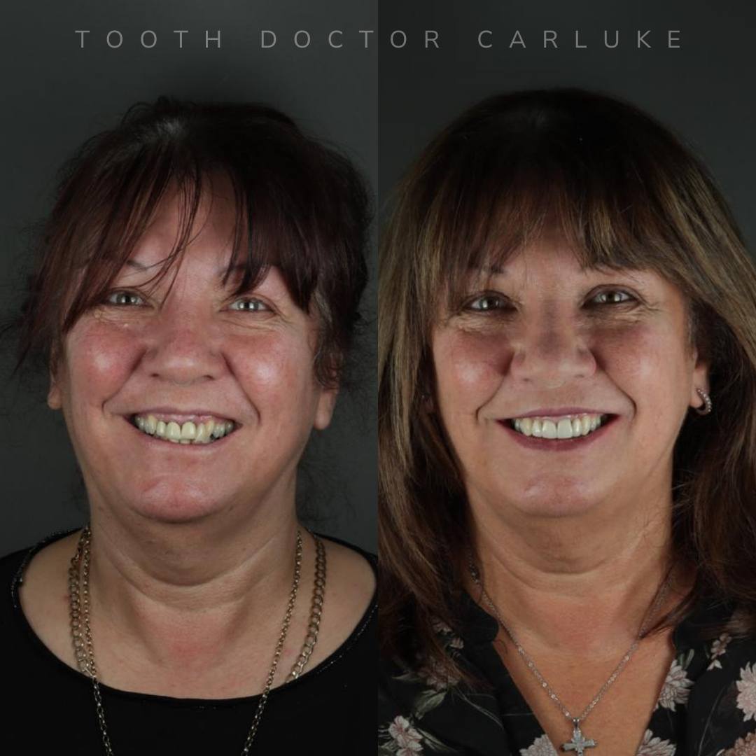 Before and after treatment