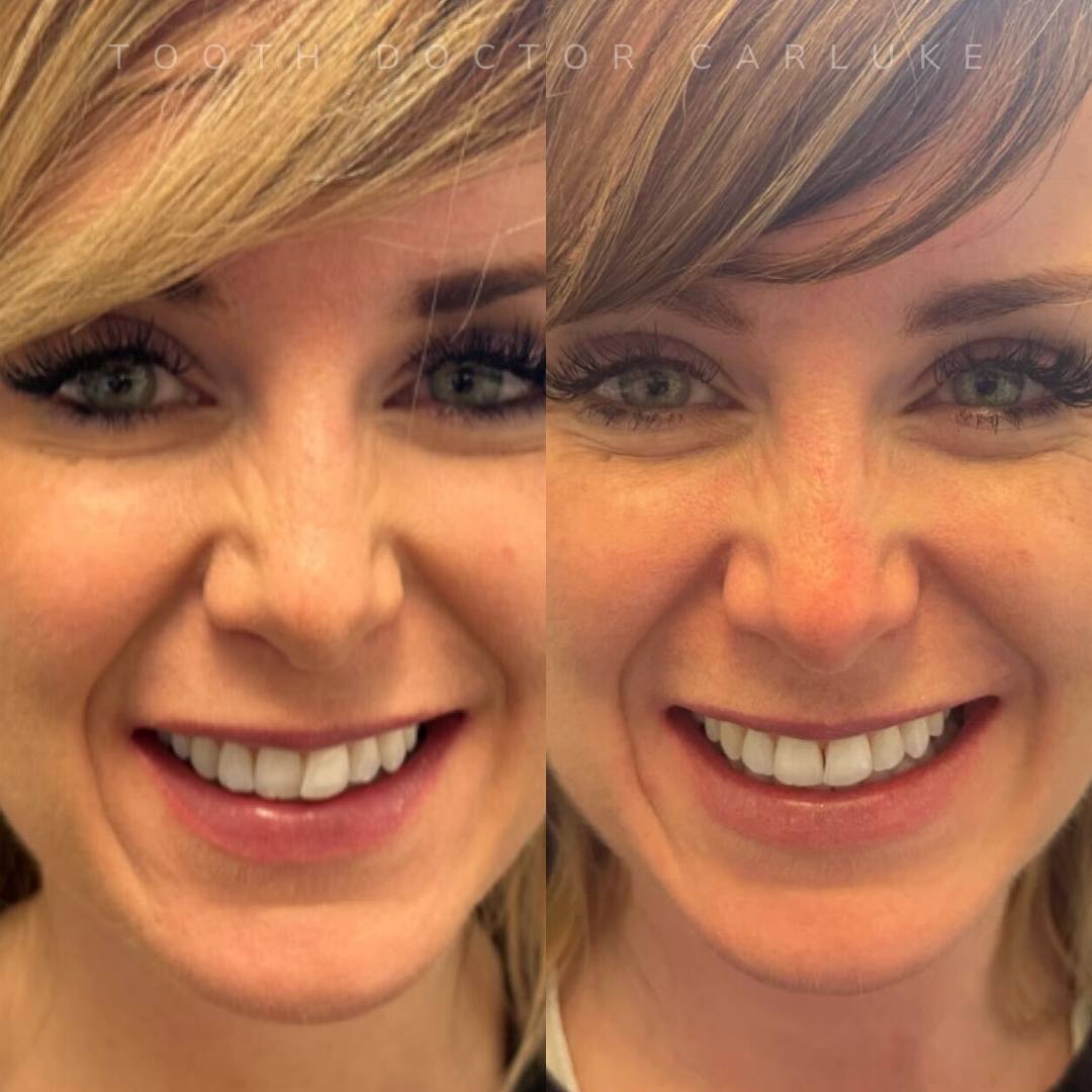 Before and after treatment