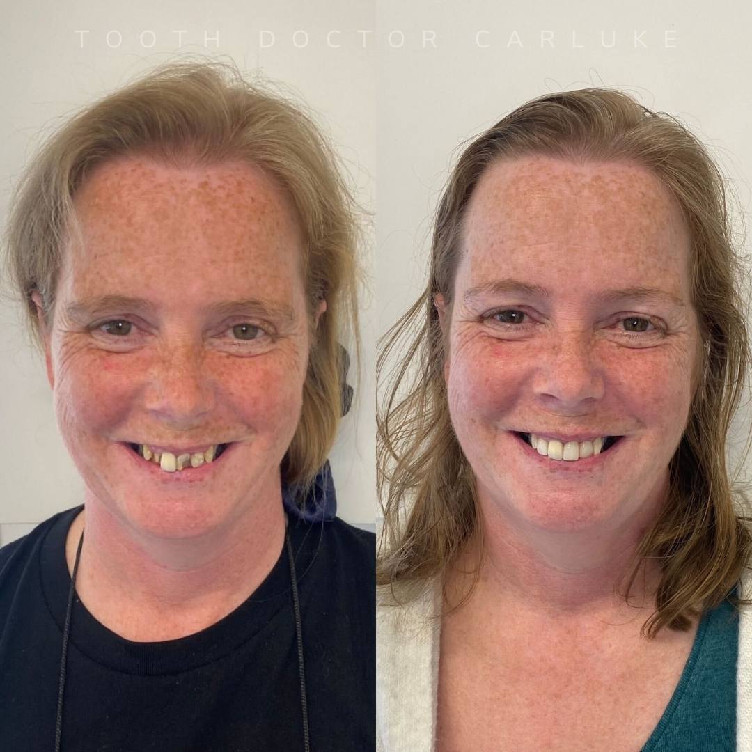 Before and after treatment