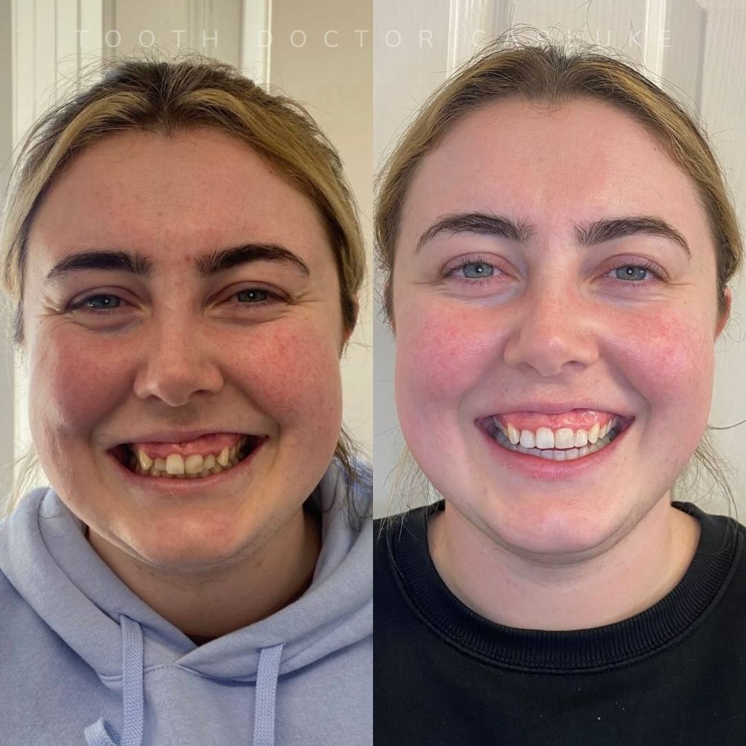 Before and after treatment