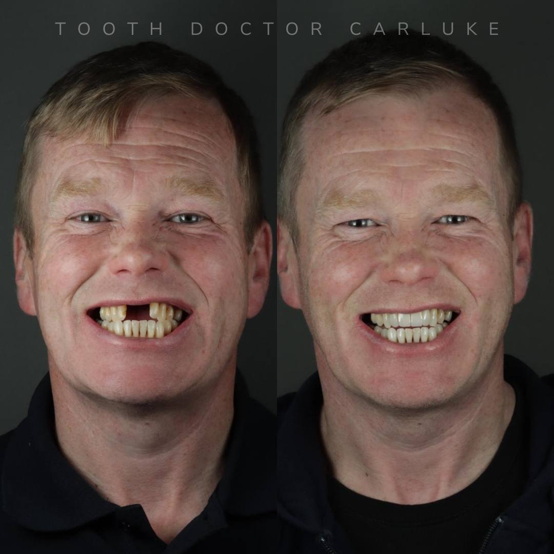 Before and after treatment
