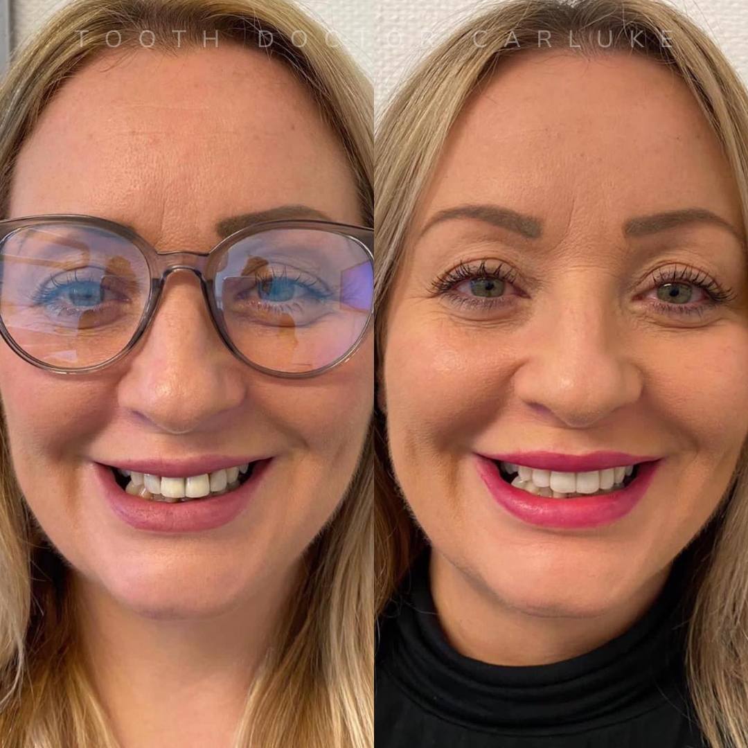 Before and after treatment