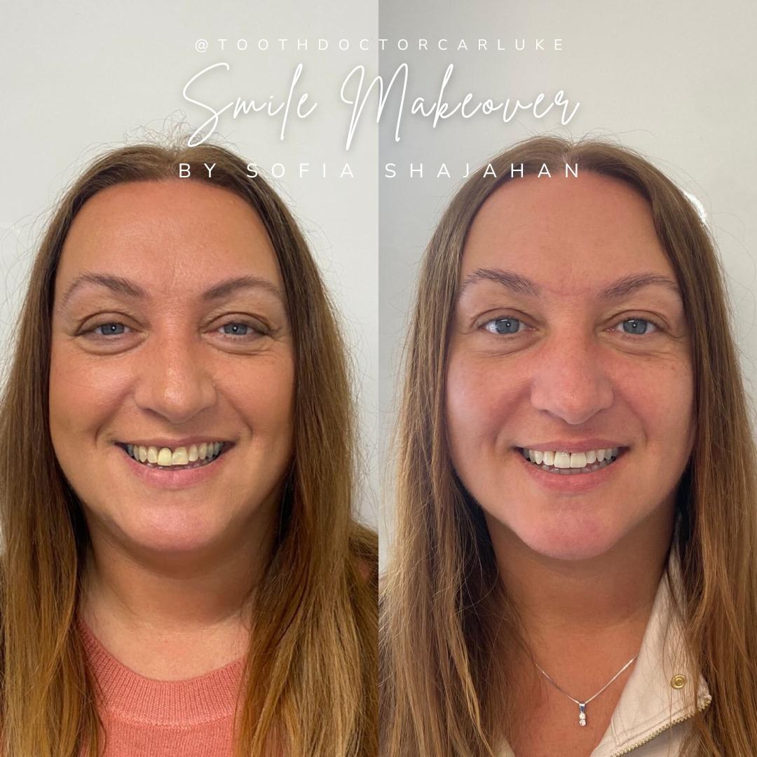 Before and after treatment at Tooth Doctor