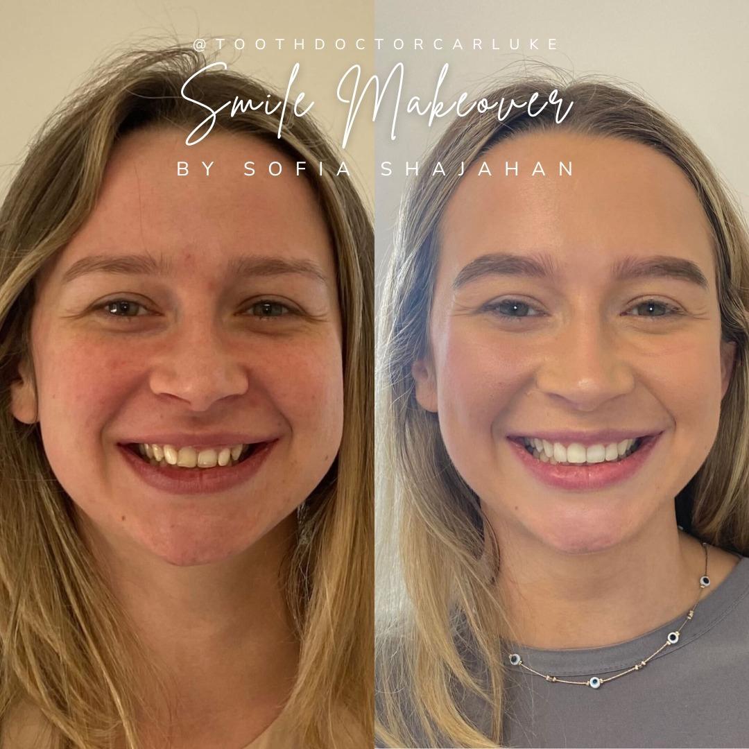 Before and after treatment at Tooth Doctor