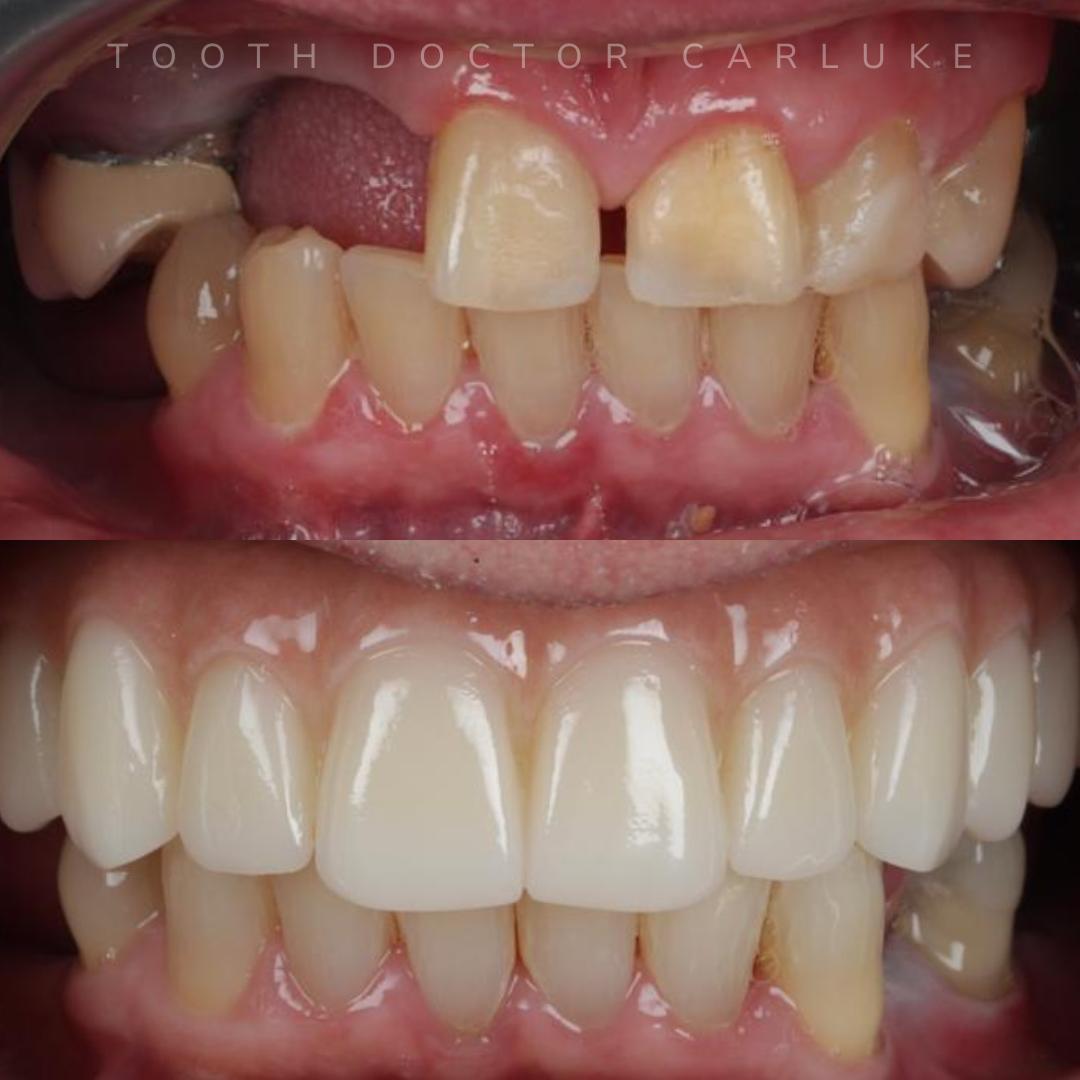 Tooth Doctor | Dental Implants Carluke Replace Missing Teeth Tooth Doctor | Dental Implants Carluke Replace Missing Teeth