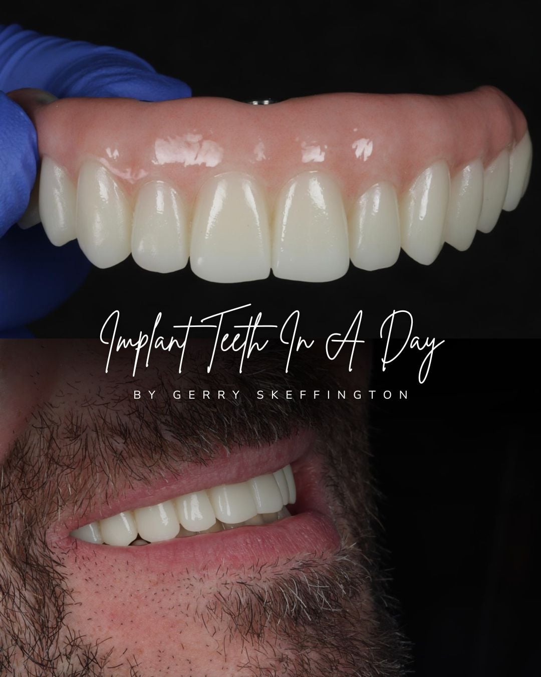 Before and after treatment