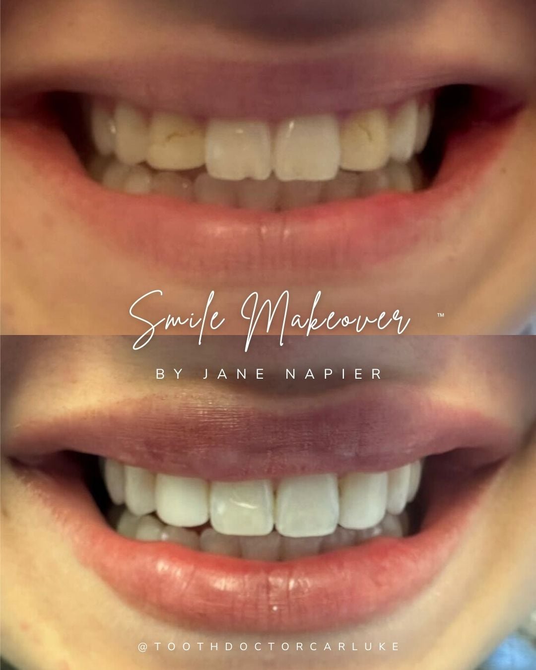 Before and after treatment