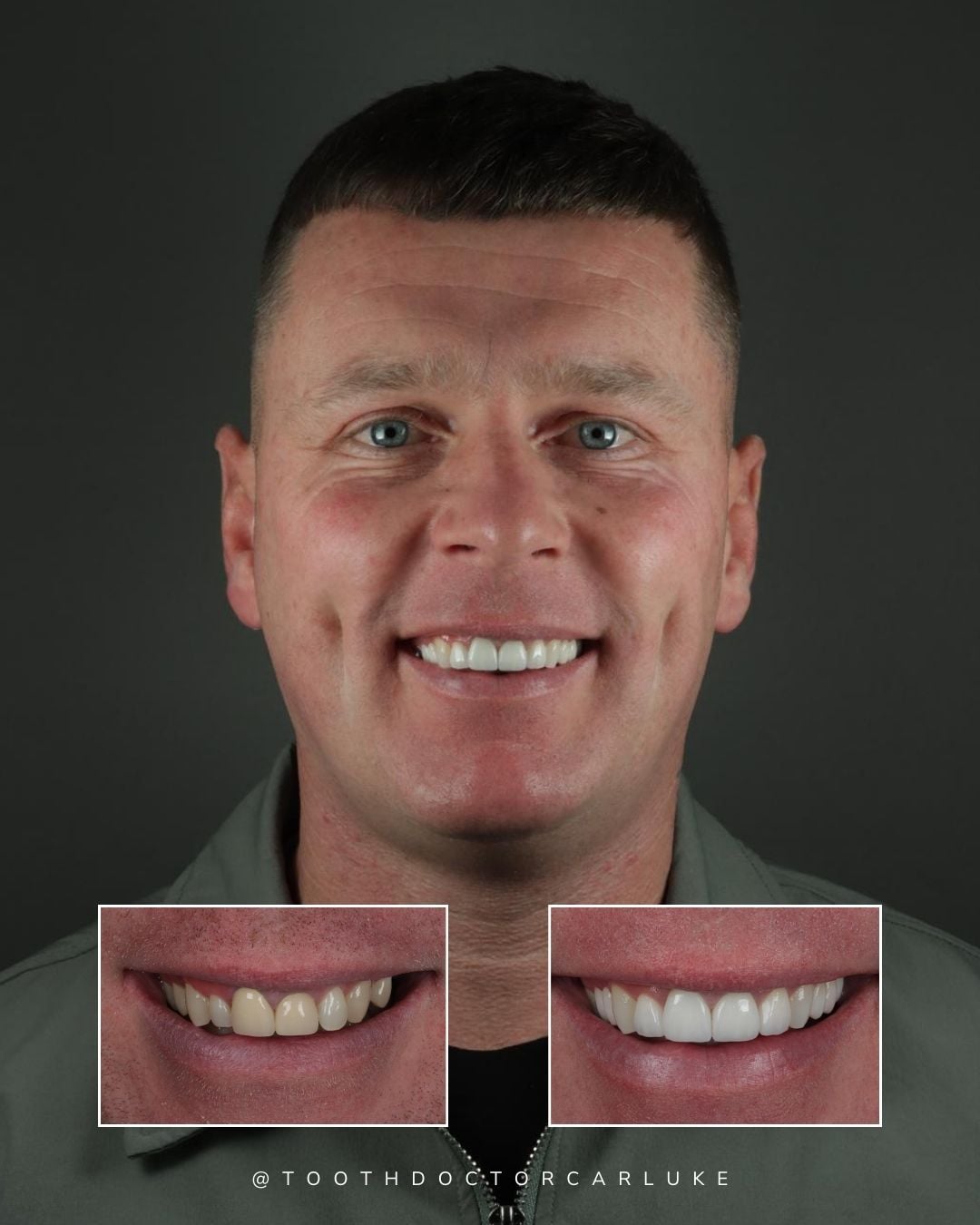 Before and after treatment