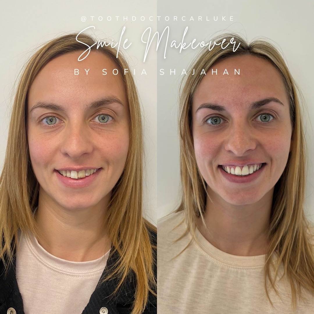 Before and after treatment