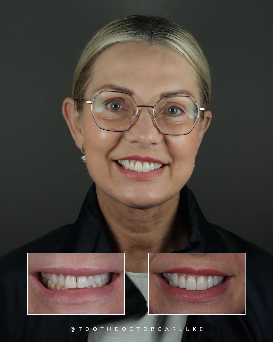 Before and after treatment