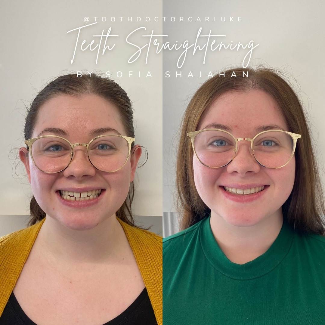 Before and after treatment