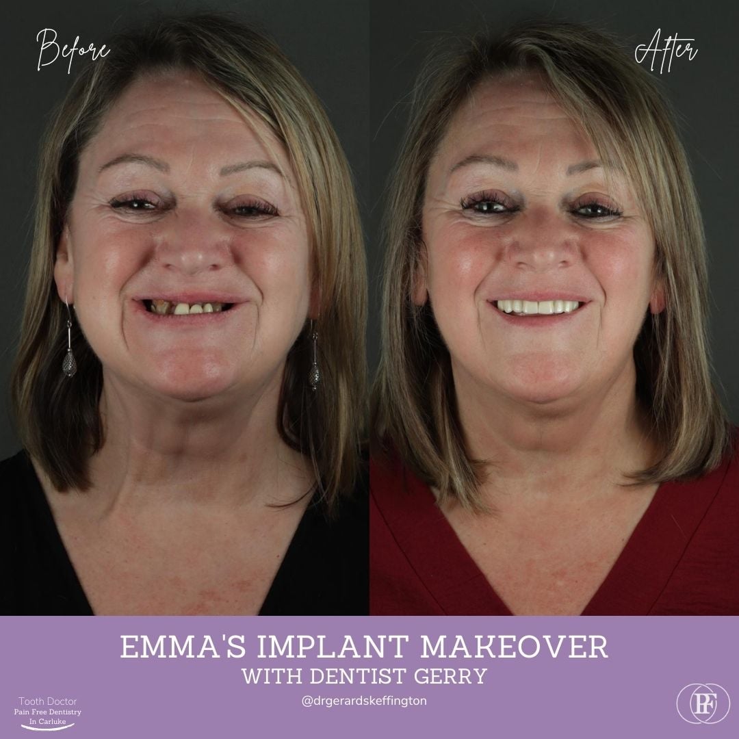 Tooth Doctor | Emma's Smile Story Ross's Smile Story with Andy