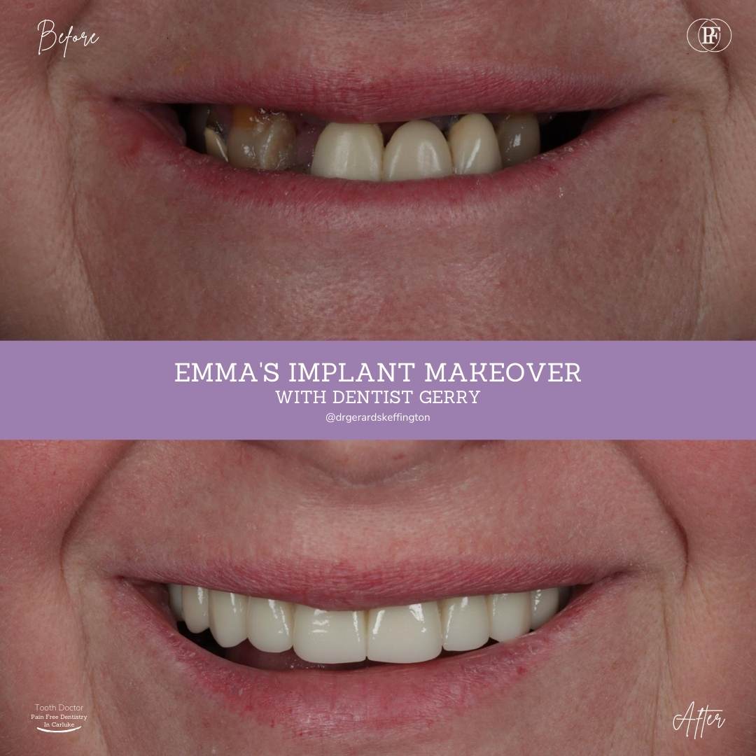 Tooth Doctor | Emma's Smile Story Tooth Doctor | Emma's Smile Story