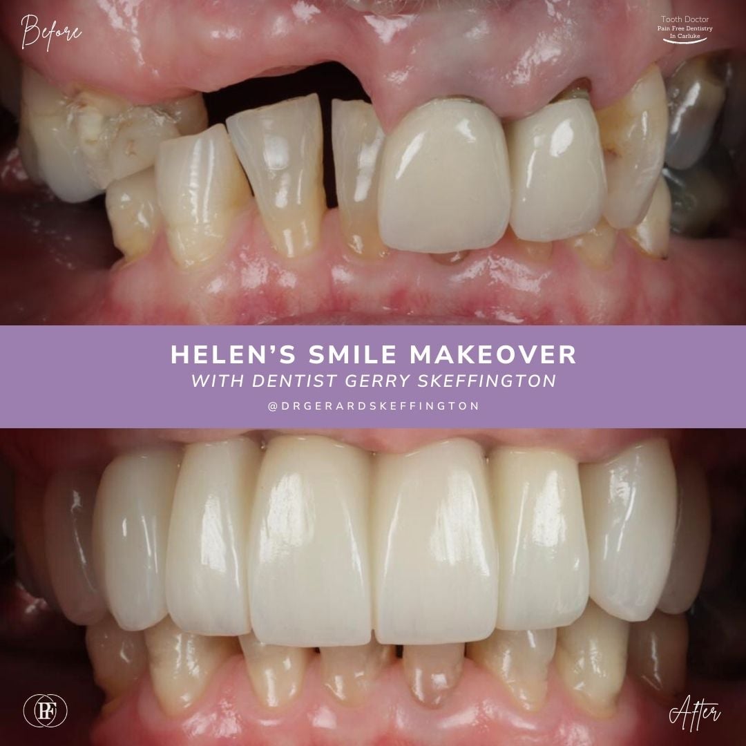 Helen's Smile Story with Andy