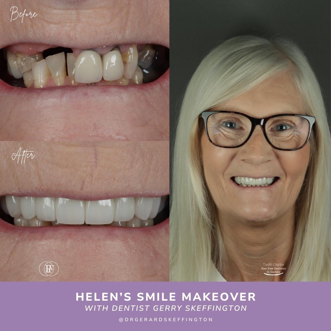 Tooth Doctor | Helen's Smile Story