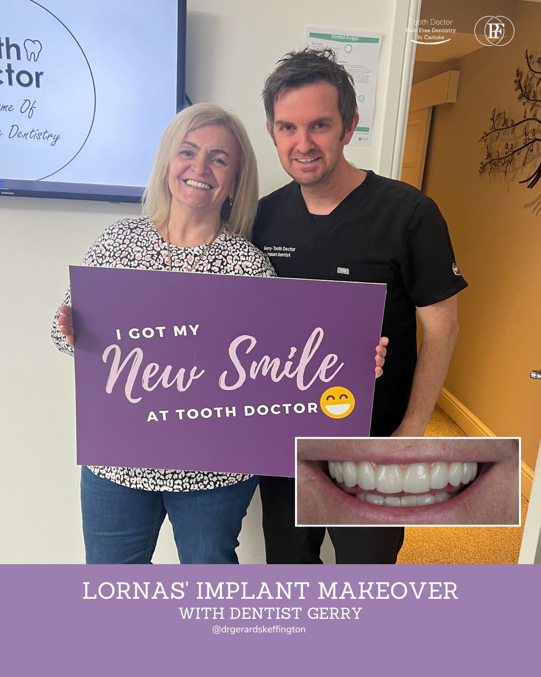 Smile Design in Carluke