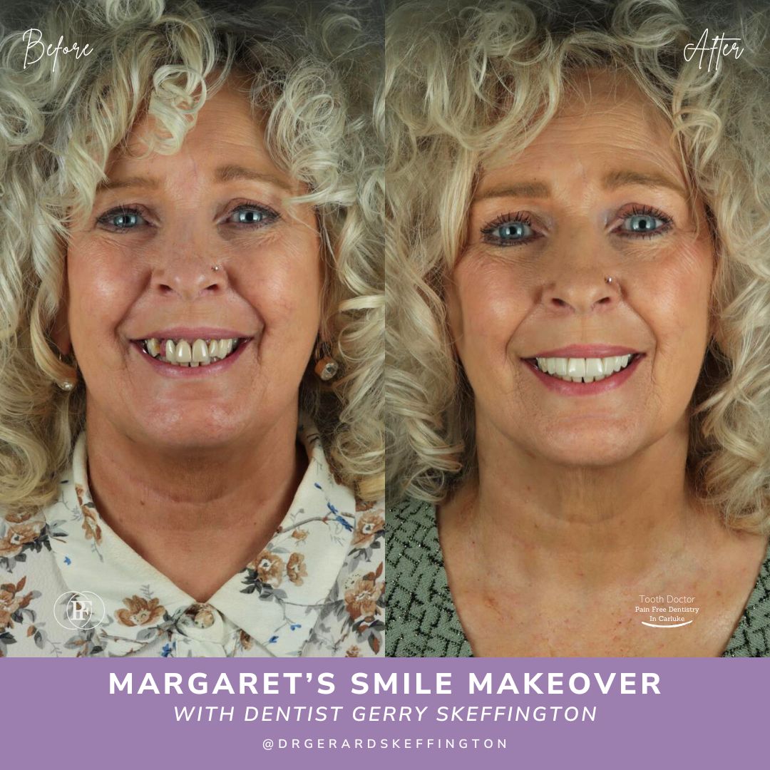 Tooth Doctor | Margaret's Smile Story