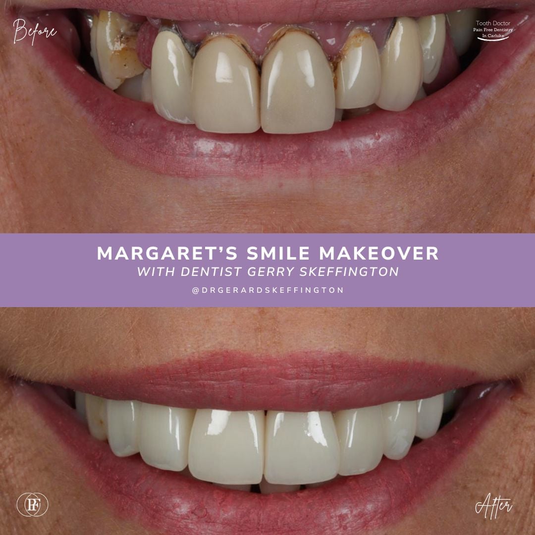 Teeth Whitening in Carluke