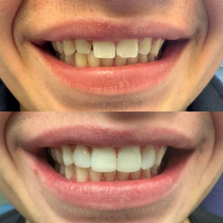 Transforming Smiles
