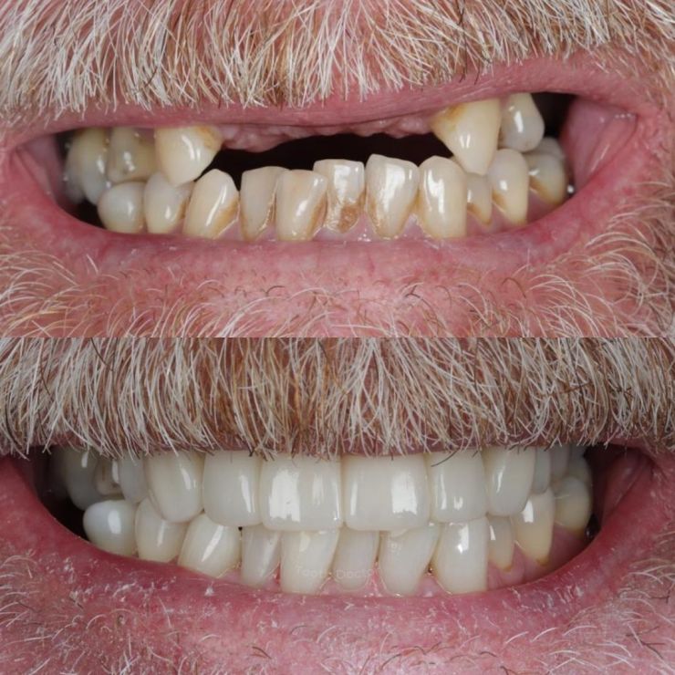 Transforming Smiles