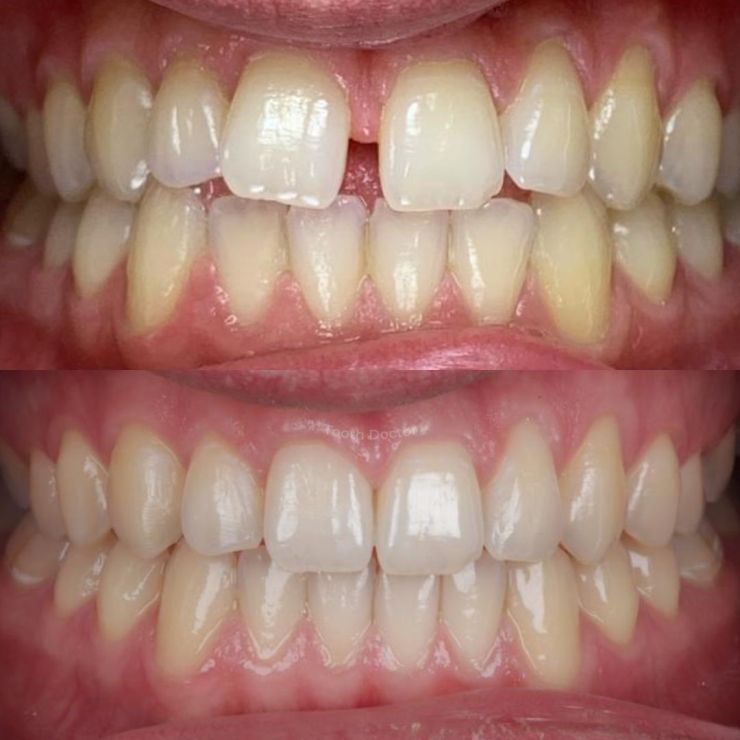 Transforming Smiles