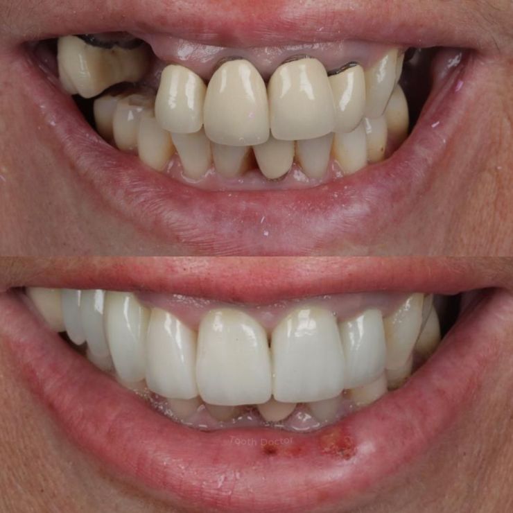 Transforming Smiles