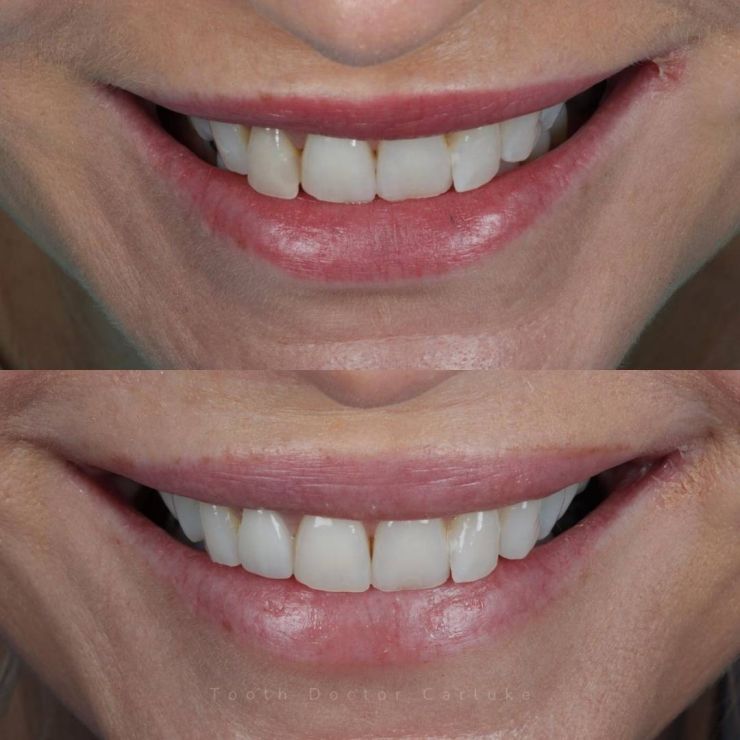 Transforming Smiles