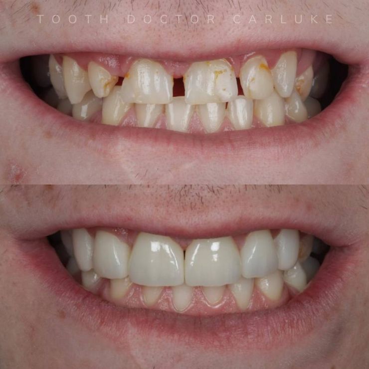 Transforming Smiles