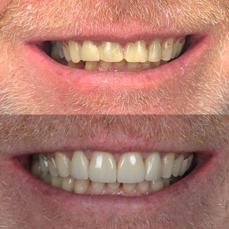 Transforming Smiles
