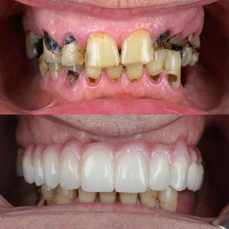 Transforming Smiles