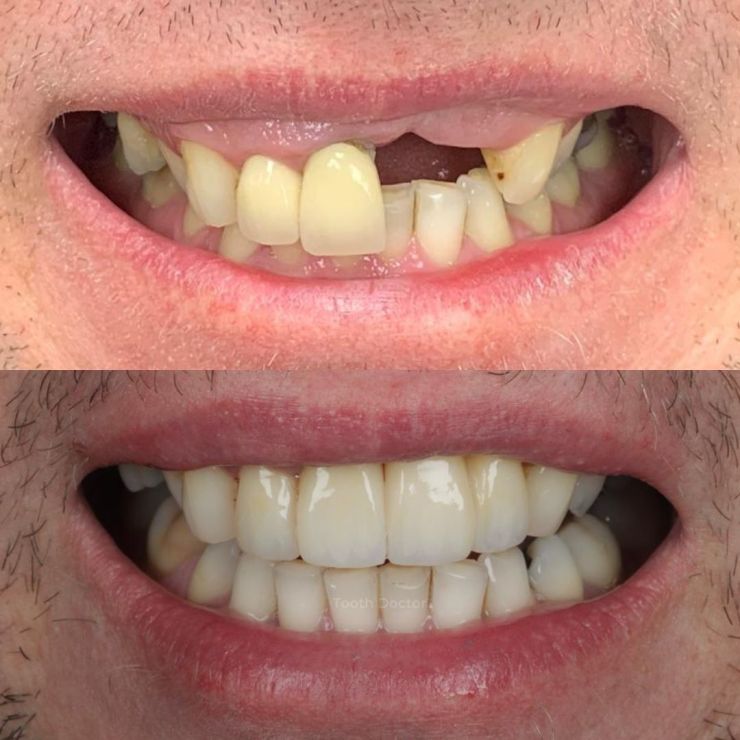Transforming Smiles