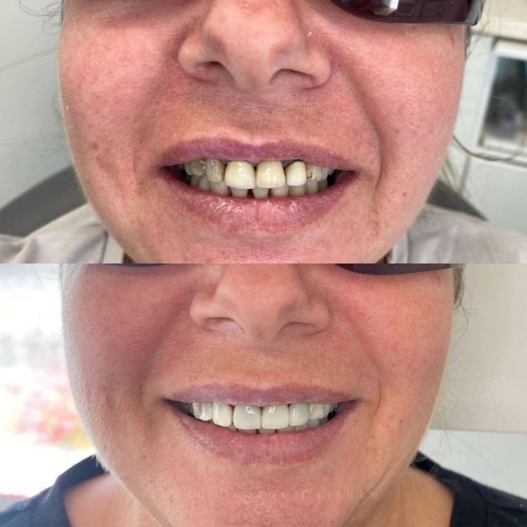 Transforming Smiles