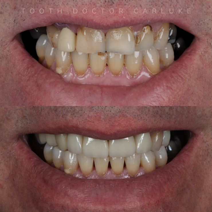 Transforming Smiles