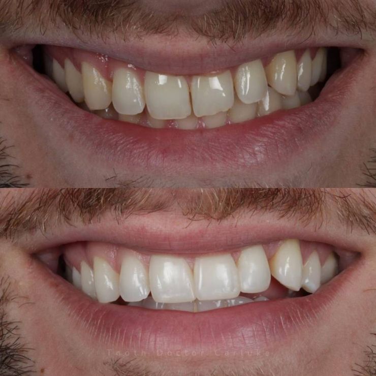 Transforming Smiles